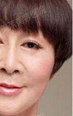 逆龄童颜